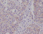 CPT2 Antibody in Immunohistochemistry (Paraffin) (IHC (P))