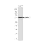 CPT2 Antibody in Western Blot (WB)