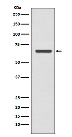CPT2 Antibody in Western Blot (WB)