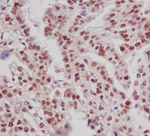 Phospho-Estrogen Receptor alpha (Ser118) Antibody in Immunohistochemistry (Paraffin) (IHC (P))