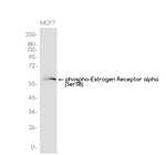 Phospho-Estrogen Receptor alpha (Ser118) Antibody in Western Blot (WB)