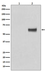 Phospho-Estrogen Receptor alpha (Ser118) Antibody in Western Blot (WB)