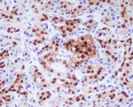PDX1 Recombinant Rabbit Monoclonal Antibody (K01_4R37)