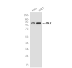 Abl2 Antibody in Western Blot (WB)