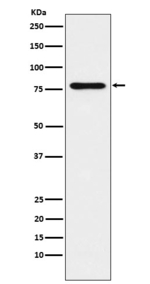 UNC84B Antibody in Western Blot (WB)