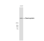 Desmoplakin Antibody in Western Blot (WB)