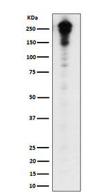 Desmoplakin Recombinant Rabbit Monoclonal Antibody (K01_4R59)