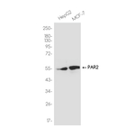 PAR2 Recombinant Rabbit Monoclonal Antibody (K01_4R60)