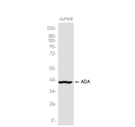 Adenosine Deaminase Antibody in Western Blot (WB)