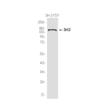 SLIT2 Antibody in Western Blot (WB)