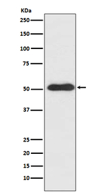 SLIT2 Recombinant Rabbit Monoclonal Antibody (K01_4R68)