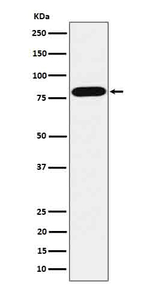 ABCD1 Recombinant Rabbit Monoclonal Antibody (K01_4R70)