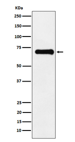 Phospho-PAK4/6/7 (Ser474, Ser602, Ser560) Recombinant Rabbit Monoclonal Antibody (K01_4R71)