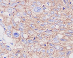 GLUT1 Antibody in Immunohistochemistry (Paraffin) (IHC (P))