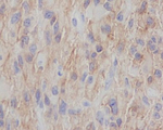 NGFR Recombinant Rabbit Monoclonal Antibody (K01_4R87)