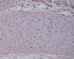 Aggrecan Recombinant Rabbit Monoclonal Antibody (K01_4R88)