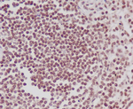 Phospho-POLR2A (Ser5) Antibody in Immunohistochemistry (Paraffin) (IHC (P))