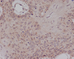 Estrogen Receptor alpha Antibody in Immunohistochemistry (Paraffin) (IHC (P))