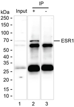 Estrogen Receptor alpha Antibody in Immunoprecipitation (IP)