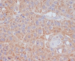 ATG9A Antibody in Immunohistochemistry (Paraffin) (IHC (P))