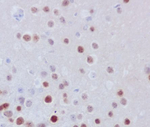 FosB Recombinant Rabbit Monoclonal Antibody (K01_4S27)