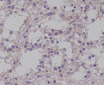 Phospho-TRKB (Tyr817) Recombinant Rabbit Monoclonal Antibody (K01_4S28)