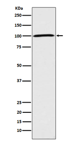 ATP1A1 Antibody in Western Blot (WB)