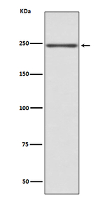 MYH6 Antibody in Western Blot (WB)