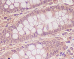 MYLK Recombinant Rabbit Monoclonal Antibody (K01_4S53)
