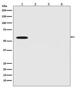 Firefly luciferase Antibody in Western Blot (WB)
