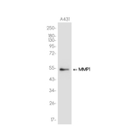 MMP1 Antibody in Western Blot (WB)
