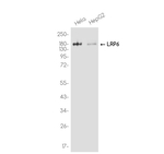 LRP6 Recombinant Rabbit Monoclonal Antibody (K01_4S86)