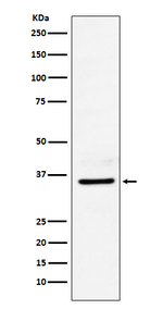 LDHB Recombinant Rabbit Monoclonal Antibody (K01_4T02)