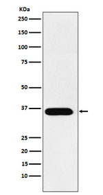 Tartrate Resistant Acid Phosphatase Recombinant Rabbit Monoclonal Antibody (K01_4T07)