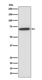 Perilipin 1 Recombinant Rabbit Monoclonal Antibody (K01_4T15)