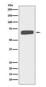 Collagen X Recombinant Rabbit Monoclonal Antibody (K01_4T17)
