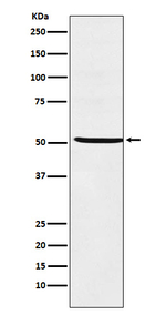 NR5A1 Recombinant Rabbit Monoclonal Antibody (K01_4T22)