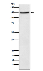 NPC1L1 Recombinant Rabbit Monoclonal Antibody (K01_4T26)