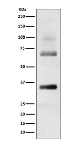 LOR Recombinant Rabbit Monoclonal Antibody (K01_4T29)