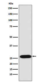 Lin28A/B Recombinant Rabbit Monoclonal Antibody (K01_4T31)