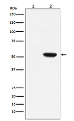 Phospho-MLKL (Ser358) Recombinant Rabbit Monoclonal Antibody (K01_4T34)