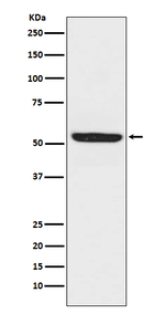 SPHK1 Recombinant Rabbit Monoclonal Antibody (K01_4T46)
