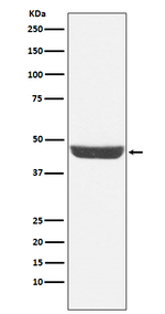 NDRG1 Recombinant Rabbit Monoclonal Antibody (K01_4T47)