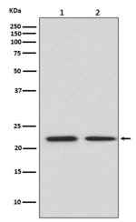 FGF21 Recombinant Rabbit Monoclonal Antibody (K01_4T55)