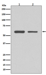 CDK8 Recombinant Rabbit Monoclonal Antibody (K01_4T78)