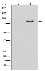 Phospho-HSL (Ser853) Recombinant Rabbit Monoclonal Antibody (K01_4T82)