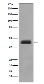 Cytokeratin 15 Recombinant Rabbit Monoclonal Antibody (K01_4T91)