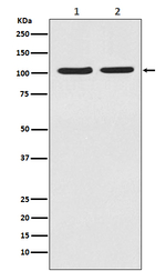 HIF-2 alpha Recombinant Rabbit Monoclonal Antibody (K01_4U03)