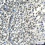 ALOX5 Recombinant Rabbit Monoclonal Antibody (K01_4U13)