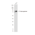 ALOX5 Antibody in Western Blot (WB)
